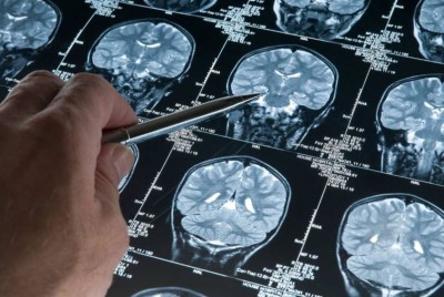 χέρι με στυλό δείχνει προς σπινθηρογραφήματα εγκεφάλων